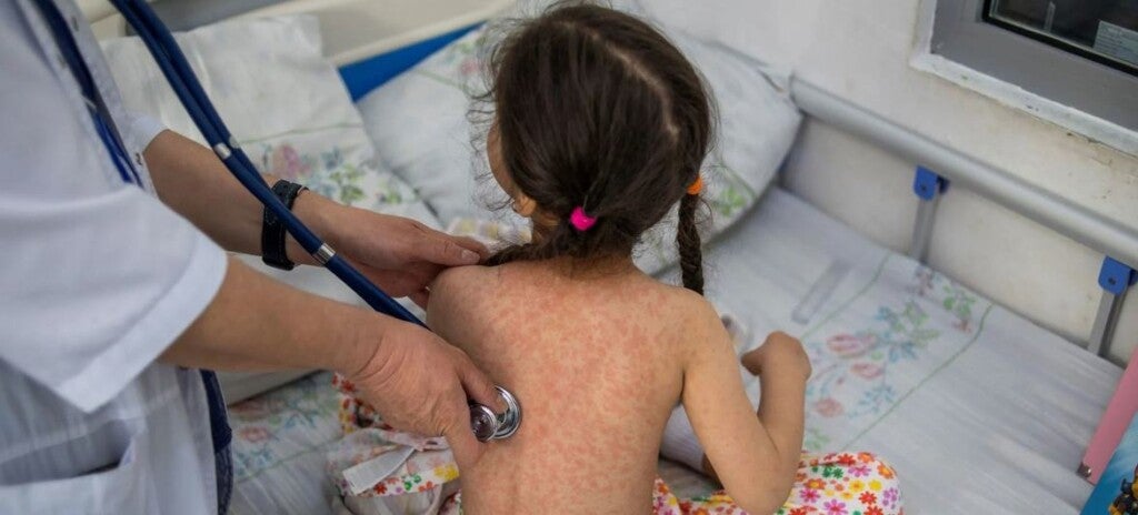 Foto: OMS/Danil Usmanov