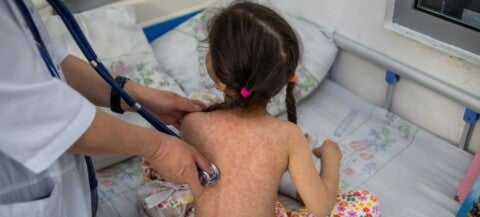 Foto: OMS/Danil Usmanov