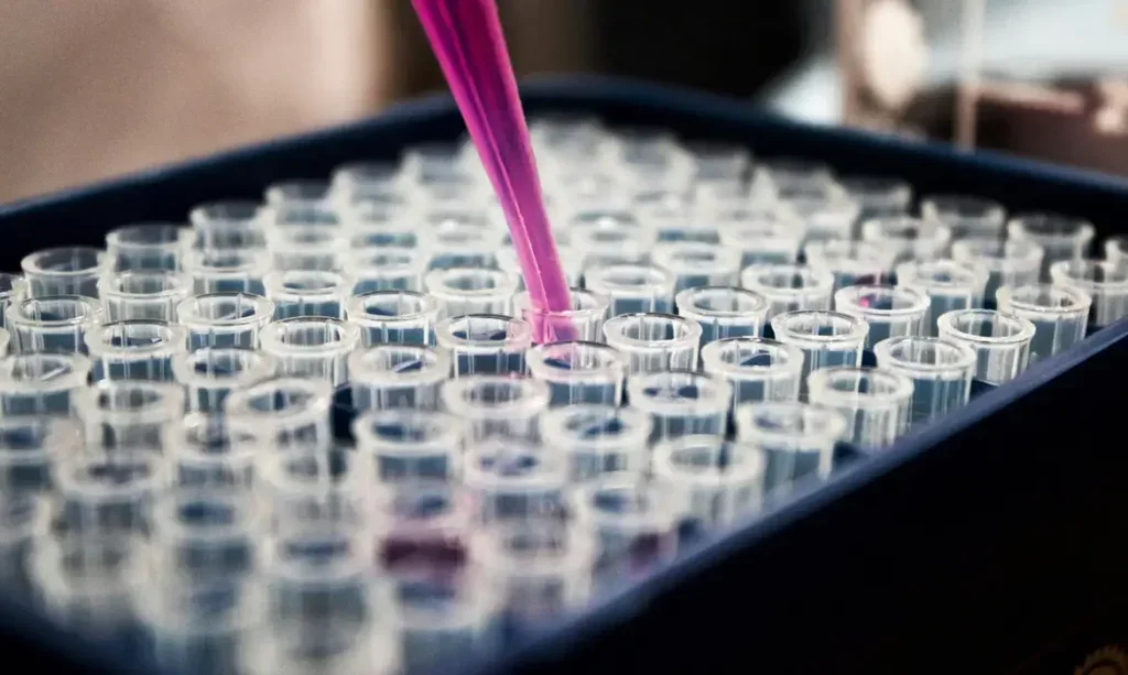 Neurocientista Eduardo Zimmer, da UFRGS, liderou o estudo que investigou a relação entre inflamação cerebral e Alzheimer - Foto: Louis Reed/ Unsplash